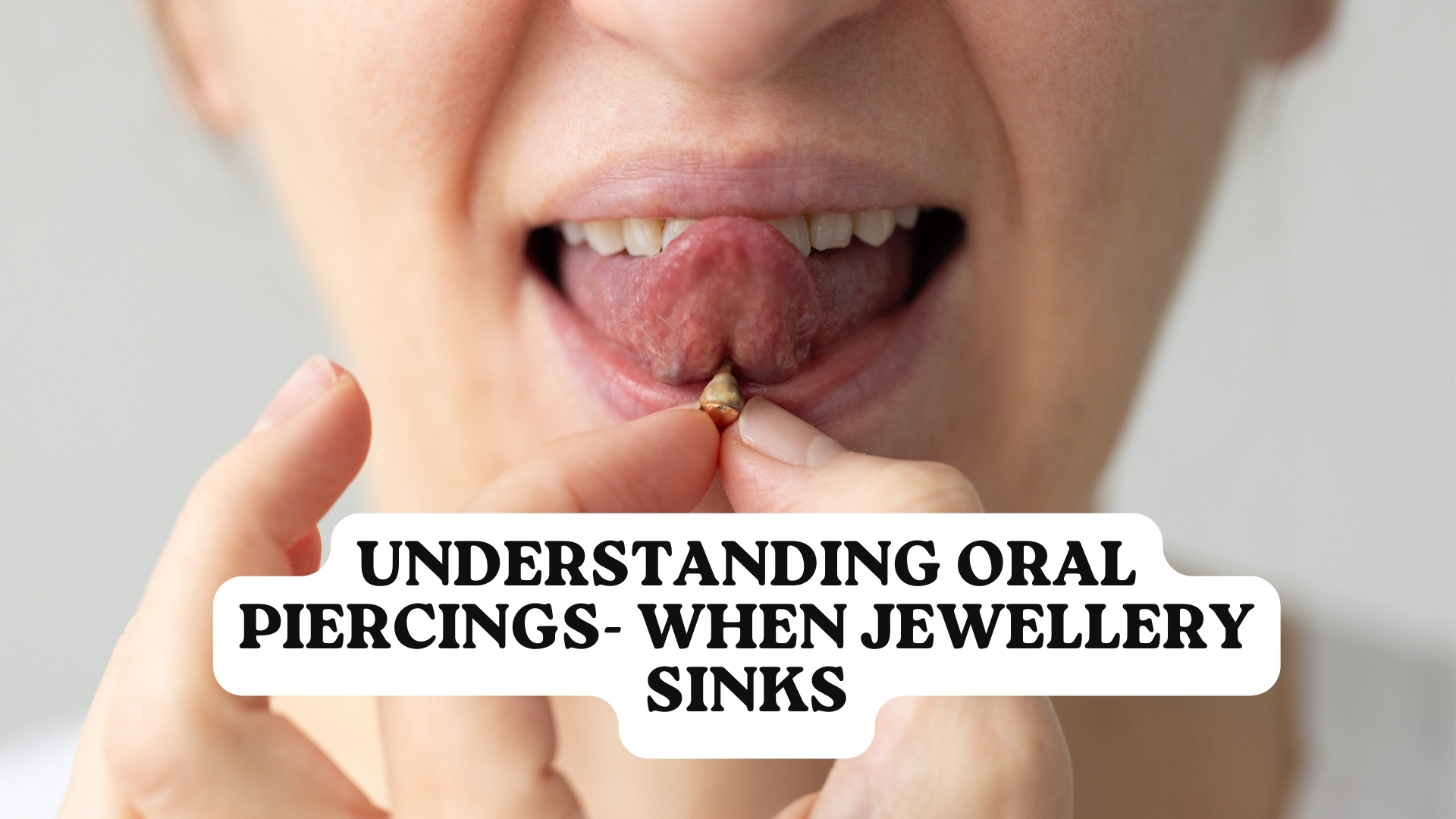Understanding Oral Piercings, When Jewellery Sinks